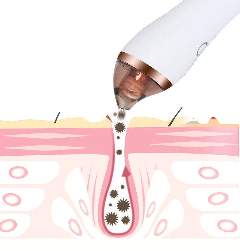 Blackhead Remover Machine | Pore Cleaning Device | This N That